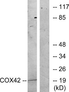 Western blot analysis of lysates from K562 cells, treated with insulin 001U/ml 15' using Anti-COX42 Antibody The right hand lane represents a negative control, where the antibody is blocked by the immunising peptide