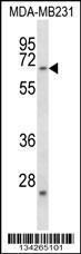 Anti-FZD2 Rabbit Polyclonal Antibody