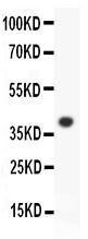 Anti-ALOX151 Polyclonal Antibody