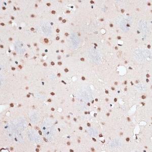 Immunohistochemistry analysis of paraffin-embedded mouse brain using Anti-RBM3 Antibody (A11899) at a dilution of 1:100 (40X lens). Perform microwave antigen retrieval with 10 mM PBS buffer pH 7.2 before commencing with IHC staining protocol