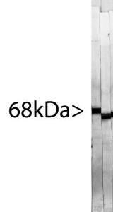 Strip blots of rat spinal cord homogenate probed with two subclones of Anti-NF-L Antibody. Both subclones, one of which became the definitive antibody, stain strongly and specifically a band at 68 kDa with essentially no background