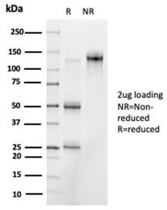 SDS-PAGE analysis of Anti-PRMT7 Antibody [PCRP-PRMT7-1A7] under non-reduced and reduced conditions; showing intact IgG and intact heavy and light chains, respectively. SDS-PAGE analysis confirms the integrity and purity of the antibody.