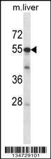 Anti-ADCK2 Rabbit Polyclonal Antibody (Biotin)