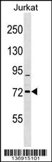 Anti-RHOBTB1 Rabbit Polyclonal Antibody