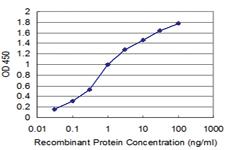 Anti-PDK4 Mouse Monoclonal Antibody [clone: 1A10]