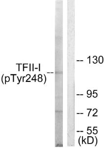 Western blot analysis of lysates from LOVO cells using Anti-TFII-I (phospho Tyr248) Antibody. The right hand lane represents a negative control, where the antibody is blocked by the immunising peptide