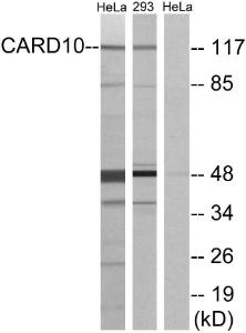 Western blot analysis of lysates from HeLa and 293 cells using Anti-CARD10 Antibody. The right hand lane represents a negative control, where the antibody is blocked by the immunising peptide