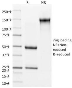 SDS-PAGE analysis of Anti-Involucrin Antibody [SY5] under non-reduced and reduced conditions; showing intact IgG and intact heavy and light chains, respectively. SDS-PAGE analysis confirms the integrity and purity of the antibody.