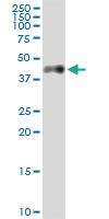 Anti-CA12 Polyclonal Antibody Pair