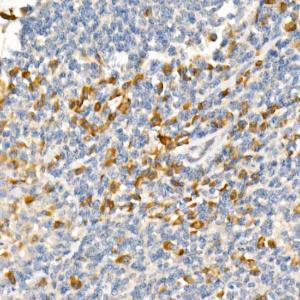 Immunohistochemistry analysis of paraffin-embedded human tonsil using Anti-TRAF2 Antibody [ARC51292] (A305567) at a dilution of 1:500 (40X lens). Perform high pressure antigen retrieval with 10 mM citrate buffer pH 6.0 before commencing with IHC staining protocol