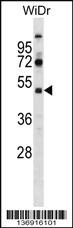 Anti-SUPT7L Rabbit Polyclonal Antibody