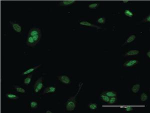 Anti-NEUROD6 Mouse Monoclonal Antibody [clone: 3B3]