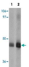 Anti-CRACR2B Rabbit Polyclonal Antibody