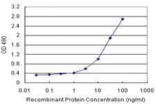 Anti-HDAC7 Polyclonal Antibody Pair