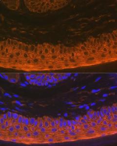 Immunofluorescence analysis of rat skin using Anti-Cytokeratin 16/K16 Antibody [ARC1783] (A307945) at a dilution of 1:100 (40X lens). DAPI was used to stain the cell nuclei (blue)