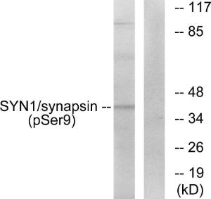 Western blot analysis of lysates from 293 cells treated with PMA 200nM 30' using Anti-Synapsin (phospho Ser9) Antibody. The right hand lane represents a negative control, where the antibody is blocked by the immunising peptide