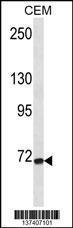 Anti-FZD3 Rabbit Polyclonal Antibody