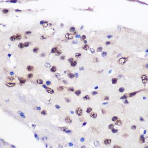 Immunohistochemistry analysis of paraffin-embedded mouse brain using Anti-CUG-BP1 Antibody (A11903) at a dilution of 1:100 (40x lens). Perform microwave antigen retrieval with 10 mM PBS buffer pH 7.2 before commencing with IHC staining protocol.