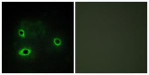 Immunofluorescence analysis of COS7 cells using Anti-COX42 Antibody The right hand panel represents a negative control, where the antibody was pre-incubated with the immunising peptide