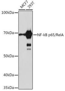 Anti-NF-kB p65 Rabbit Monoclonal Antibody [clone: ARC51086]