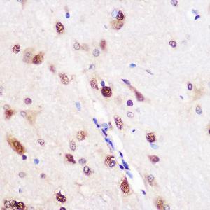 Immunohistochemistry analysis of paraffin-embedded rat brain using Anti-CUG-BP1 Antibody (A11903) at a dilution of 1:100 (40x lens). Perform microwave antigen retrieval with 10 mM PBS buffer pH 7.2 before commencing with IHC staining protocol.