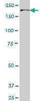 Anti-UBR1 Mouse Monoclonal Antibody [clone: 2F5]