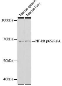 Anti-NF-kB p65 Rabbit Monoclonal Antibody [clone: ARC51086]