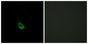 Immunofluorescence analysis of HeLa cells using Anti-CARD10 Antibody. The right hand panel represents a negative control, where the antibody was pre-incubated with the immunising peptide