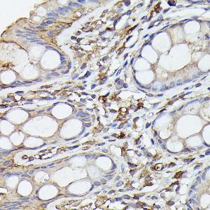 Anti-NF-kB p65 Rabbit Monoclonal Antibody [clone: ARC51086]