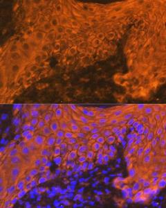 Immunofluorescence analysis of human skin using Anti-Cytokeratin 16/K16 Antibody [ARC1783] (A307945) at a dilution of 1:100 (40X lens). DAPI was used to stain the cell nuclei (blue)