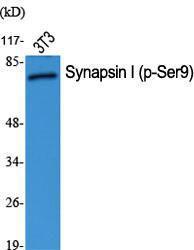 Western blot analysis of various cells using Anti-Synapsin (phospho Ser9) Antibody