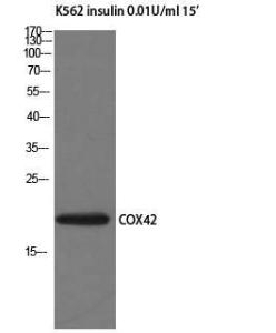 Western blot analysis of K562 insulin 001U/ml 15' cells using Anti-COX42 Antibody