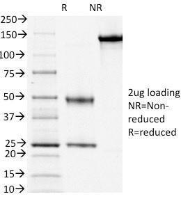 SDS-PAGE analysis of Anti-CD3 epsilon Antibody [PC3/188A] under non-reduced and reduced conditions; showing intact IgG and intact heavy and light chains, respectively. SDS-PAGE analysis confirms the integrity and purity of the antibody