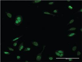 Anti-NEUROD6 Mouse Monoclonal Antibody [clone: 3B3]