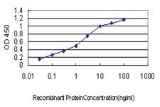 Anti-UBR1 Mouse Monoclonal Antibody [clone: 2F5]