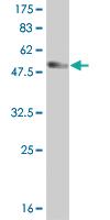 Anti-HDAC7 Mouse Monoclonal Antibody [clone: 2B11-1C1]