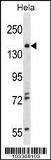 Anti-TNIK Rabbit Polyclonal Antibody (HRP (Horseradish Peroxidase))