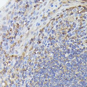 Anti-NF-kB p65 Rabbit Monoclonal Antibody [clone: ARC51086]