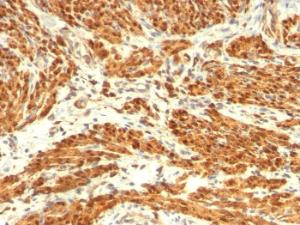 Immunohistochemical analysis of formalin-fixed, paraffin-embedded human uterus using Anti-Calponin 1 Antibody [CNN1/832 + CALP]