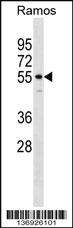 Anti-IQCB1 Rabbit Polyclonal Antibody