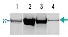 Anti-PYGM Rabbit Polyclonal Antibody