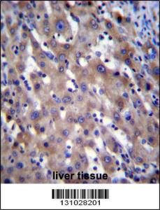 Anti-RPGR Rabbit Polyclonal Antibody (FITC (Fluorescein Isothiocyanate))