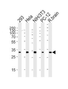 Anti-RPS6 Mouse Monoclonal Antibody [clone: 981CT2.1.1]