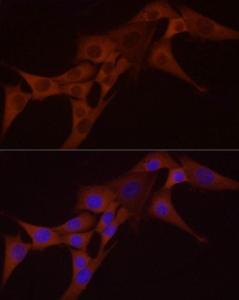 Anti-NF-kB p65 Rabbit Monoclonal Antibody [clone: ARC51086]