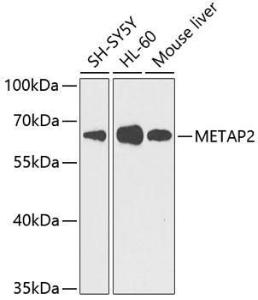 Anti-Methionine Aminopeptidase 2/p67 antibody