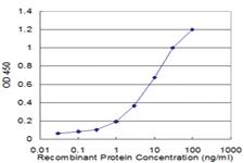 Anti-NEUROD6 Mouse Monoclonal Antibody [clone: 3B3]