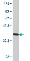 Anti-ABCB9 Mouse Polyclonal Antibody