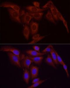 Anti-NF-kB p65 Rabbit Monoclonal Antibody [clone: ARC51086]