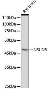 Western blot analysis of extracts of Rat brain, using Anti-NSUN5 Antibody (A11908) at 1:1,000 dilution. The secondary antibody was Goat Anti-Rabbit IgG H&L Antibody (HRP) at 1:10,000 dilution.