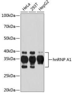 Western blot analysis of extracts of various cell lines, using Anti-hnRNP A1 Antibody [ARC0633] (A305568) at 1:1,000 dilution. The secondary antibody was Goat Anti-Rabbit IgG H&L Antibody (HRP) at 1:10,000 dilution.